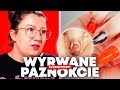 DRAMAT WYRWANYCH PAZNOKCI! Dramatyczne historie KU PRZESTRODZE