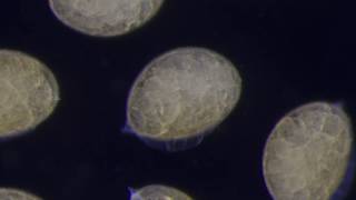 Time lapse of dragonfly embryo development (libellula quadrimaculata)