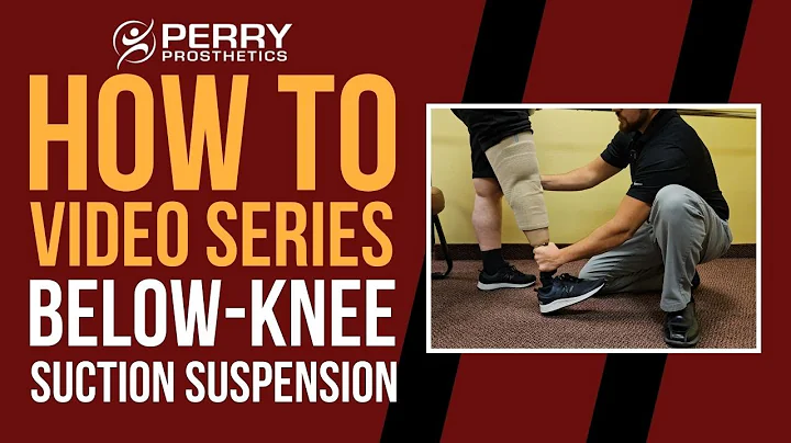 Below Knee Prosthetic Suction Suspension: How-To Series