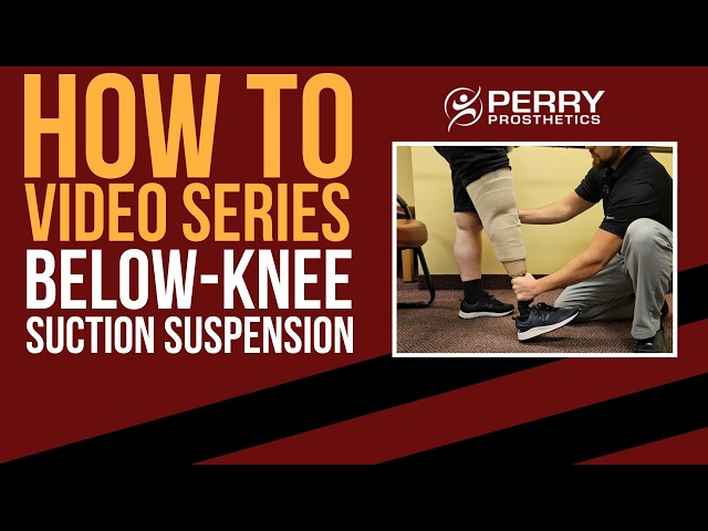 Below Knee Prosthetic Suction Suspension: How-To Series