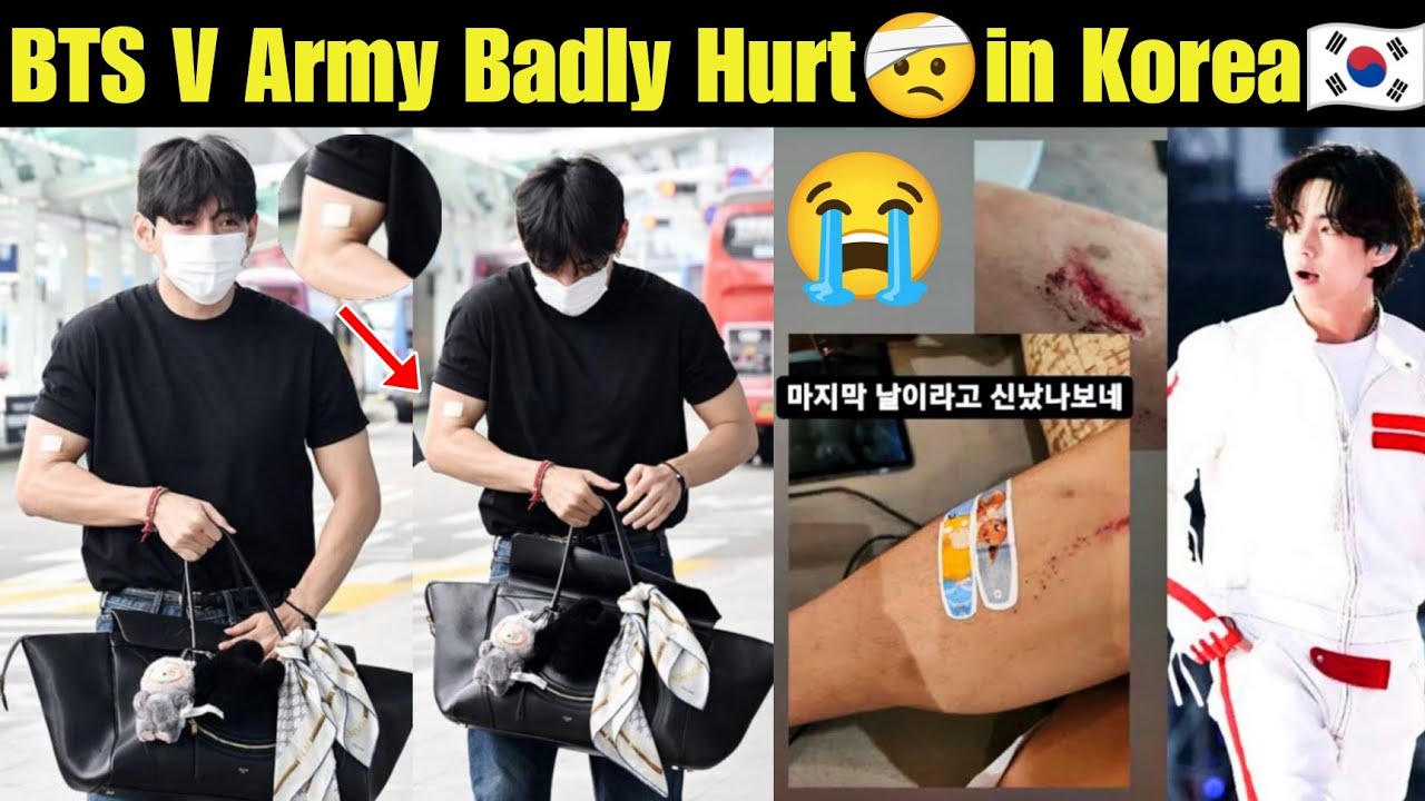 BTS V Hand Badly Injured 🤕 Hurt in Korea 🇰🇷 Taehyung Injury