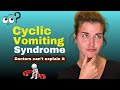 Stop the Cycle: The Surprising Spinal Link to Unexplained Vomiting (CVS).
