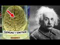 Voici comment le cerveau deinstein tait diffrent