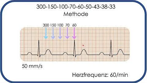 Wie kann man die Herzfrequenz ermitteln?