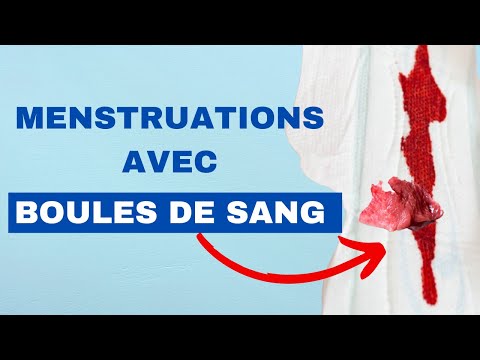 PERIODS WITH BLOODY PATCHES HERE ARE THE REASONS