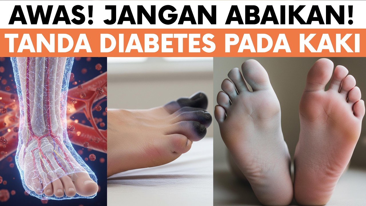 Tanda-Tanda Diabetes Pada Kaki! Anda WAJIB TAHU!