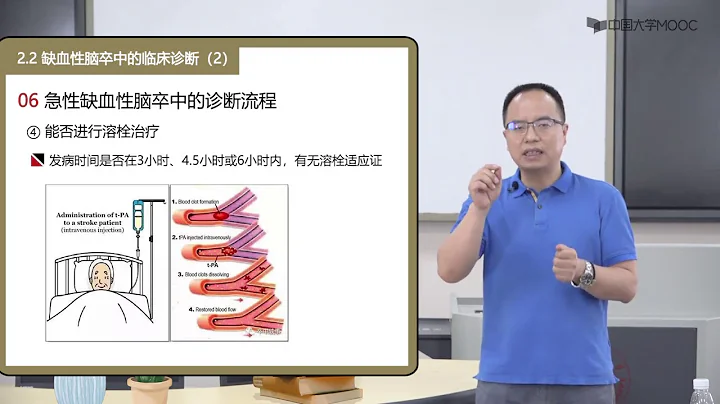 2 2缺血性腦卒中的臨床診斷2 - 天天要聞
