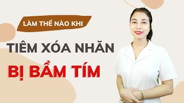 Làm thế nào khi tiêm botox xóa nhăn bị bầm tím I Bùi Hương Thắng