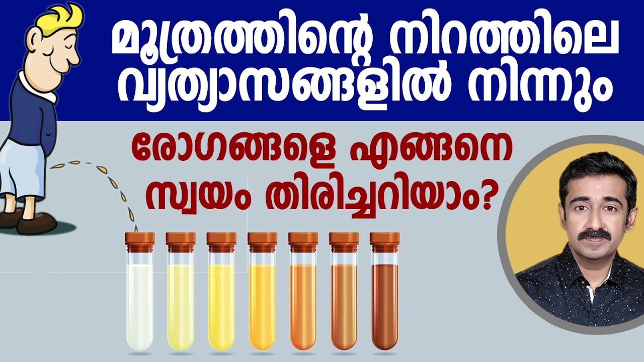 മൂത്രത്തിന്റെ നിറം നോക്കി രോഗങ്ങളെ തിരിച്ചറിയുന്നത് എങ്ങനെ ? അറിഞ്ഞിരിക്കുന്നത് നല്ലതാണ്
