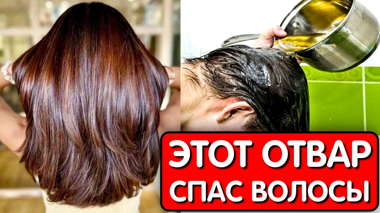 Этот ОТВАР СПАС ОТ ВЫПАДЕНИЯ ВОЛОС ! Мои волосы растут как сумасшедшие даже на залысинах