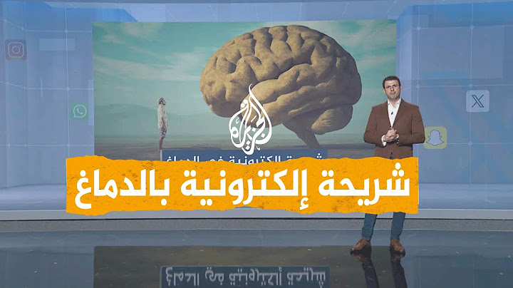شبكات | زراعة شريحة في رأس إنسان لأول مرة.. ما تفعله مذهل