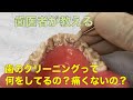 【横浜戸塚　内藤歯科】歯のクリーニングってどんなことをしているの？