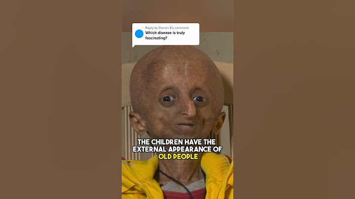 What is Progeria?