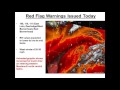 NWS Missoula Fire Weather Briefing July 20th 2017