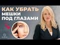 Отеки век и мешки под глазами. Как убрать синяки под глазами?