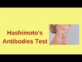 Thyroglobulin Antibodies in Hashimoto’s Thyroiditis