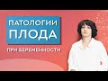 Патология плода при беременности. Формула материнства.