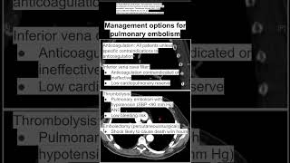 Management options for pulmonary embolism