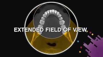 CS 8200 3D CBCT System With Extended Fields of View