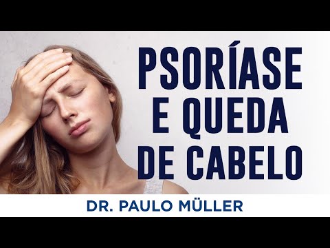 Vídeo: 3 maneiras de diagnosticar a psoríase do couro cabeludo