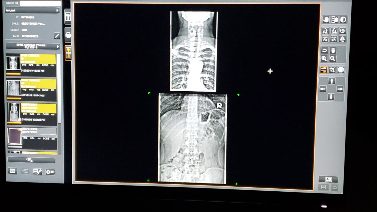 Image suite stitching tool - YouTube