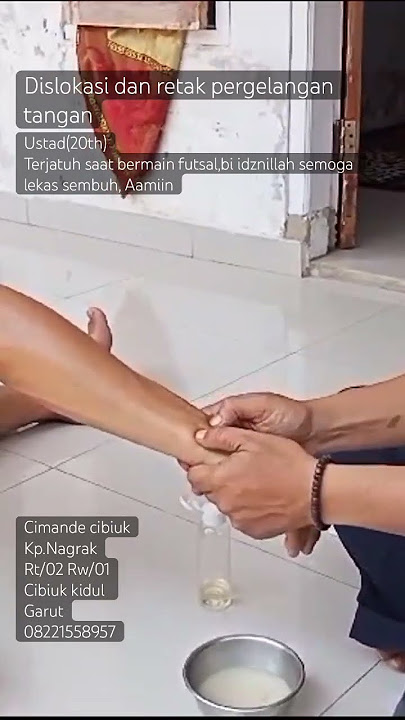 Dislokasi dan retak pergelangan tangan.. #shortvideo #viral #youtubeshorts
