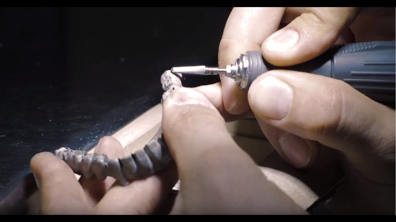 LASER MELTING - rimozione supporti di stampa