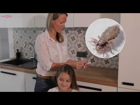 فيديو: لدغات البعوض عند الأطفال: كيفية تشويه