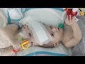 The Unbelievable Story and Live-Saving Surgery of Conjoined Twins - Pickler & Ben