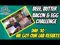 Beef Butter Bacon & Egg challenge day 10 | Our Cholesterol after 4 years on Keto | SHOCKING RESULTS