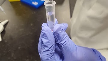 Finger pin prick blood sample preparation for MALDI ToF mass spectrometry