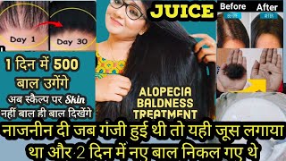 Extremely Magical Regrowth Hair Juice/ Naazneen di jab Ganji hui ye Juice lagya 7Days New Hair aaye