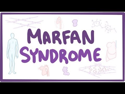 Vídeo: Síndrome de Marfan