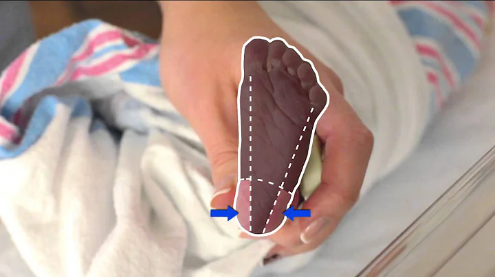 CLSI Newborn Screening DVD | Informational Video (Clip) - DayDayNews