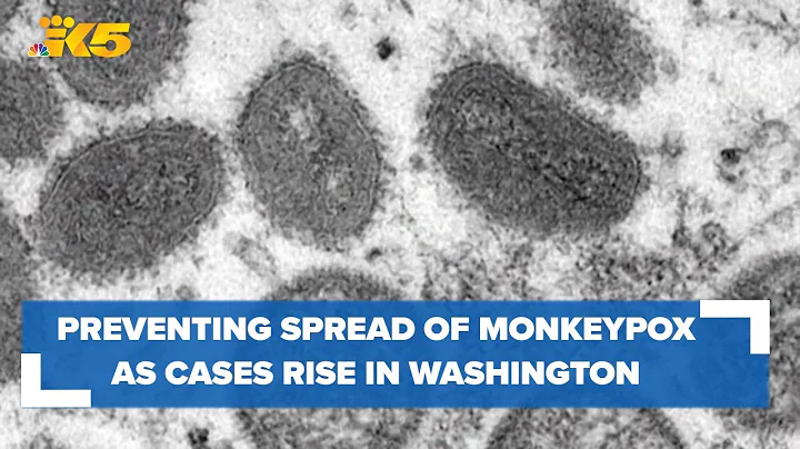 Preventing spread of monkeypox as cases rise in Washington