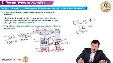 5. Types of Jaundice | Hemolytic, Hepatic & Obstructive | Medical Biochemistry | MBBS | USMLE Step 1