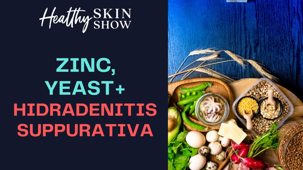 How Yeast + Zinc Can Play A Role In HIDRADENITIS SUPPURATIVA Steve