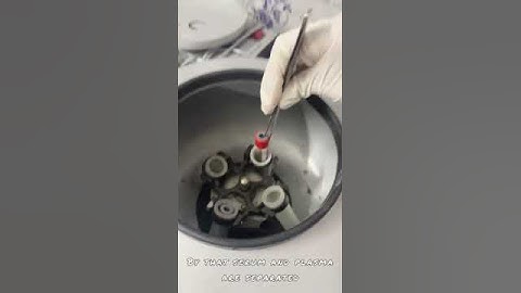 This is a sample video of dengue test for identifying dengue virus.