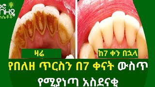 Ethiopiaየበለዘ ጥርስን በ7 ቀናት ውስጥ የሚያነጣ አስደናቂ ውህድ Nuro Bezede Girls