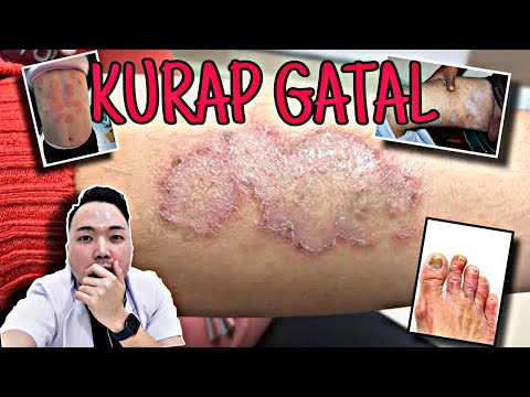 Video: 3 Cara Mengobati Masalah Kesehatan dari Jamur