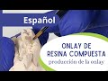 Onlay en resina compuesta - parte 4: producción de la onlay.