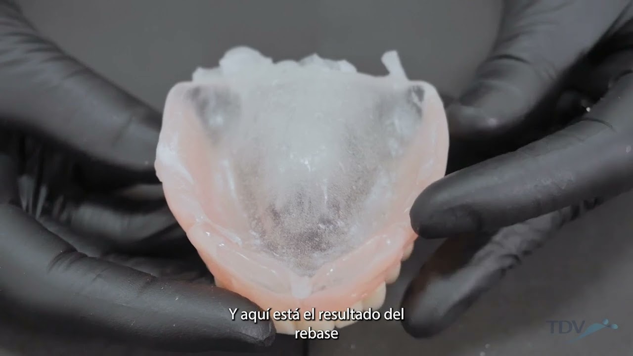 Línea de Rebases TDV - Español