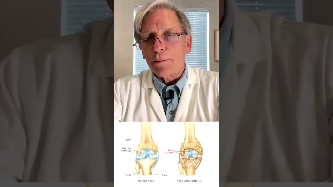 How Essential Oils Prevent Arthritis and Bone Spurs