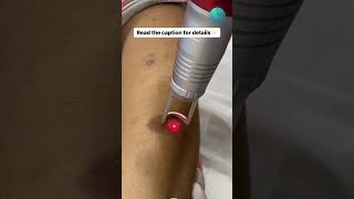 Dermatologist in Mumbai