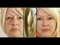 20 Dakikada Genç Görünmenin Sırrı |Cilt Kırışıkları İçin Süper Yöntem - Kırışık Giderici , AntiAging