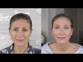 YOUNGER LOOKING SKIN IN 90 DAYS GUARANTEED! NIRA PRO LASER