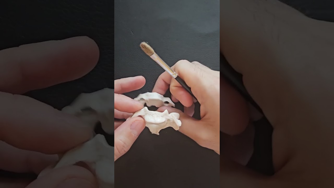 UNCINATE PROCESS, CERVICAL SPINE, 