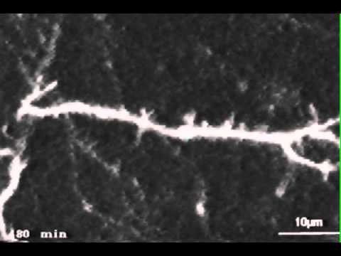 Dynamics of Dendritic Filopodia in Hippocampal Slice