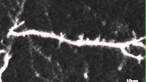 Dynamics of Dendritic Filopodia in Hippocampal Slice