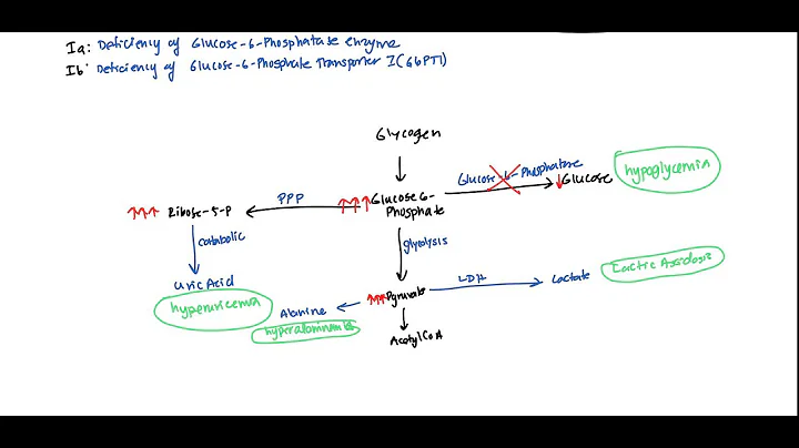 Von Gierke (Glycogen Storage Disease 1) for USMLE